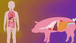 מדד הידע: האם תהיו מוכנים להשתיל בגופכם איבר של חזיר?