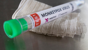 להימנע מיחסי מין: האזהרה בבריטניה למי שפיתח תסמינים של אבעבועות הקוף