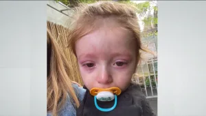 בן השנתיים בילה בג'ימבורי - ונחנק מהתקף אלרגיה: "אין מודעות"