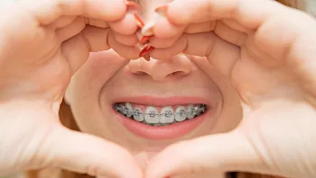 העתיד כבר כאן: יישור שיניים בשיטת אינויזליין