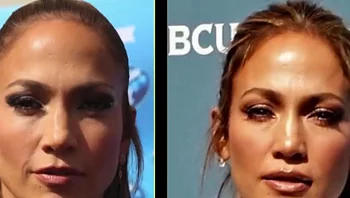 לפני ואחרי: המראה של כוכבות הוליווד בעקבות טיפולי היופי
