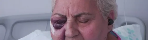 "יצאתי בנס": בת ה-72 שנפצעה בפיגוע אבנים משחזרת את רגעי האימה