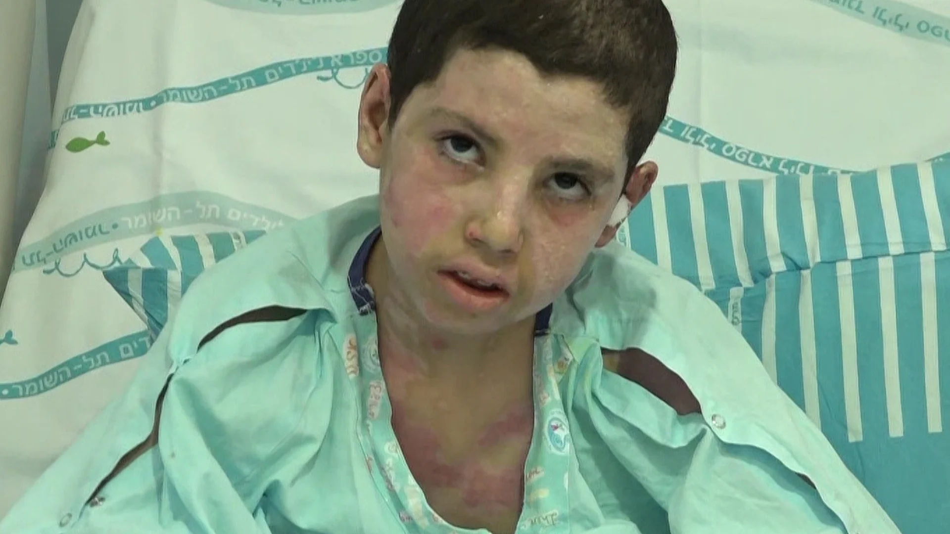 מוחמד בן ה-12 מיפו שניצל מפגיעת בקת''ב בביתו