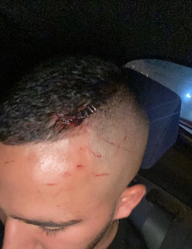 פציעה צעיר תקיפה בקבוק וודקה מועדון הדאמה תל אביב